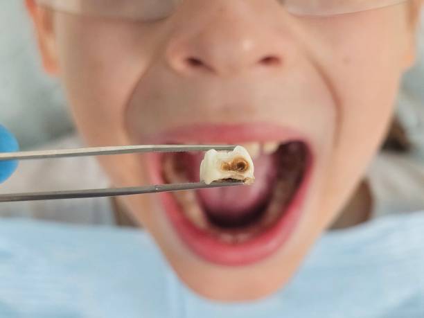 Best Emergency Orthodontic Repairs in Blackwell, OK